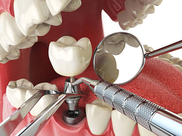 Best Emergency Treatment for Toothache in Holtville, CA